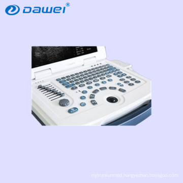 DW-580 price laptop ultrasound, cheap ultrasound equipment